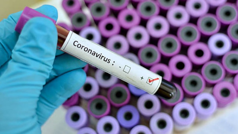 Advanced Sterilization Products on preventing the spread of coronavirus from contaminated medical devices