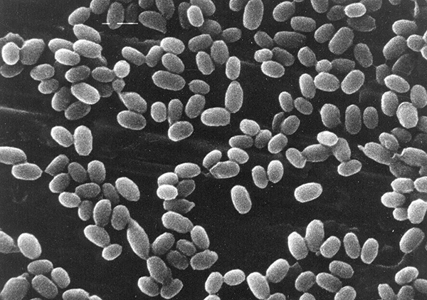 Figure 2: Bacillus subtilis endospores Magnification: x7000
