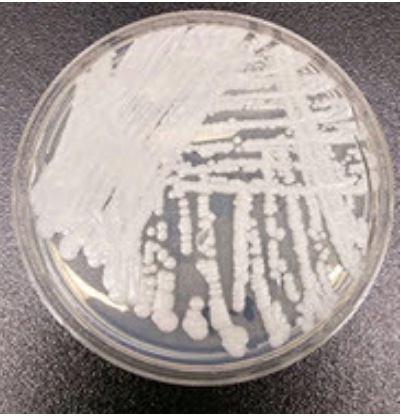 A strain of C. auris cultured in a petri dish at CDC. Image courtesy of CDC.