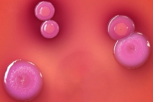 Common problems with the plate count method in cleanroom compliance
