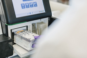 Comparing and differentiating closely related strains of bacteria