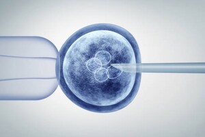 Fujifilm plans major US gene therapy facility as part of $120m investment