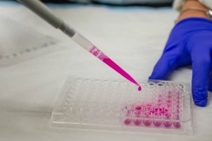 Hygiena acquires Diagnostics Food Safety division of Biomedical
