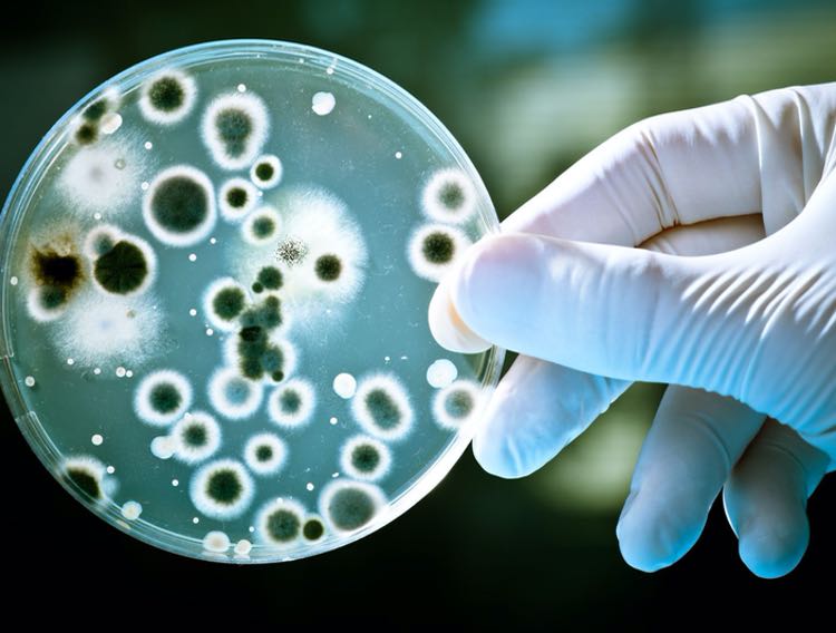 IDEXX receives UK Acceptance for Legionella pneumophila testing 