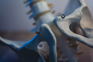 Norwood wins multi-million-pound turnkey project for orthopaedic implant production space