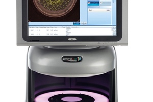Synbiosis launches automated colony identification system for use with CHROMagar