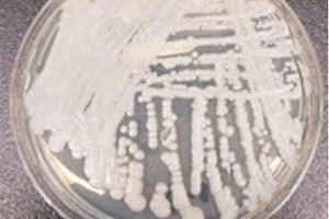 US CDC warns of ongoing transmission of Candida auris in healthcare facilities 