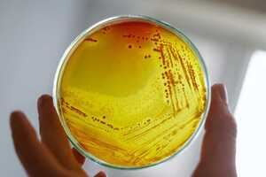 What you might miss when planning an in vitro coupon study