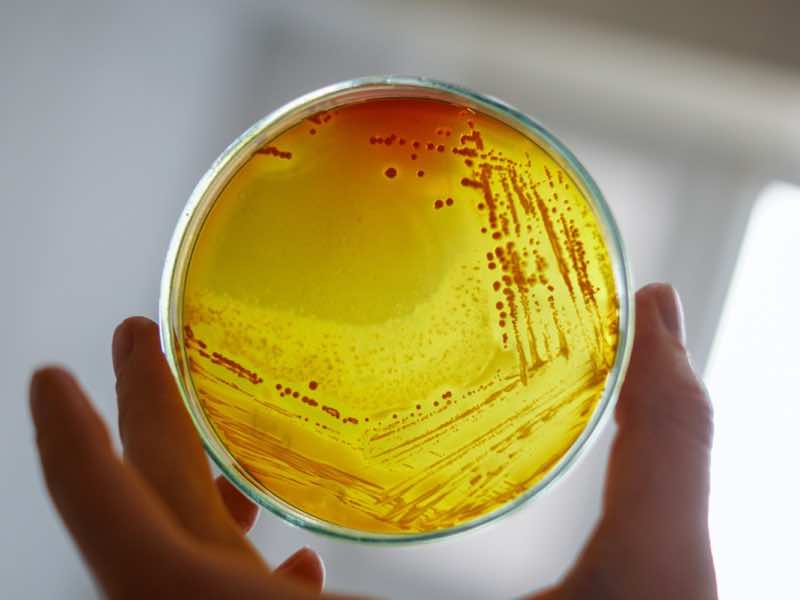 What you might miss when planning an in vitro coupon study